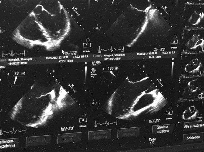 Prathima_Ultrasound